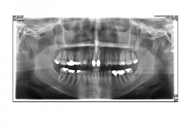 panoramica cri 27.1.72.jpg