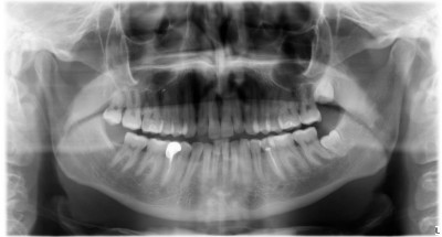Panoramica dentista ottobre 2016.jpg