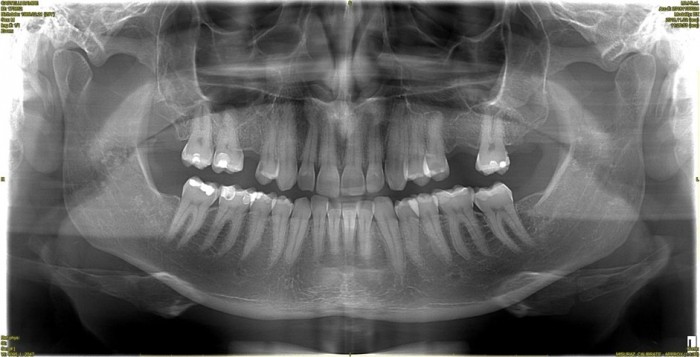 Ortopanoramica_0001 (FILEminimizer).jpg