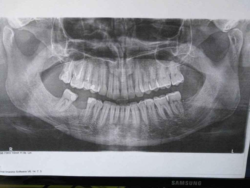 denti.jpg