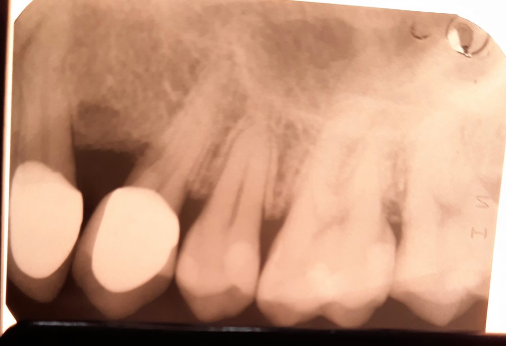 Radiografia zona 13 post-bonifica