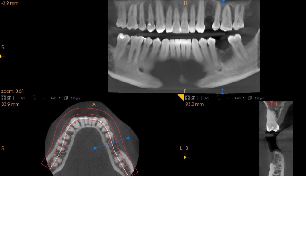 panoramica denti 3d cone beam.jpg