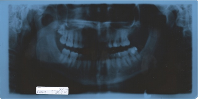 denti 2.png