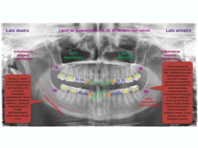 panoramica-denti-numerati.jpg